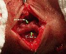 http://www.bibliomed.com.br/BancoImagens/Imagens/tmbACF2F4F.jpg