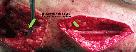 http://www.bibliomed.com.br/BancoImagens/Imagens/tmbACF2F51.jpg