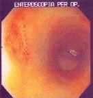 http://www.bibliomed.com.br/BancoImagens/Imagens/tmbEnteroscopia.jpg