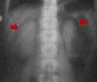 http://www.bibliomed.com.br/BancoImagens/Imagens/tmbRaio_x__simples_abdomen.jpg