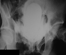 http://www.bibliomed.com.br/BancoImagens/Imagens/tmbcisto05.gif