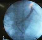 http://www.bibliomed.com.br/BancoImagens/Imagens/tmbradioscopia-cardiaca.jpg