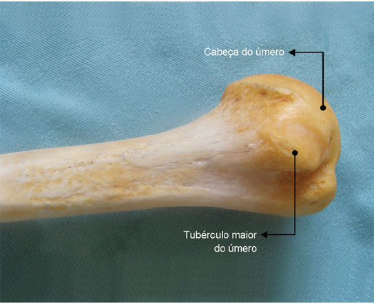 Cabeça: extremidade articular grande e arredondada