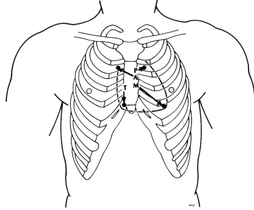fig03-22.gif