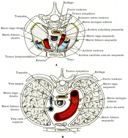 fig03-28.gif