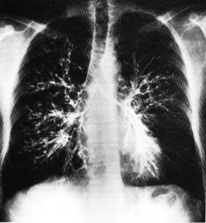 fig03-36.gif