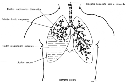 fig03-38.gif