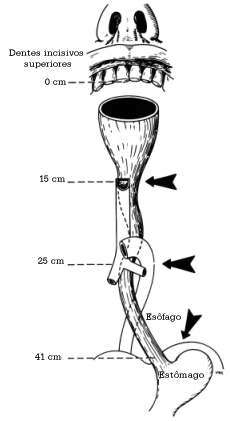 fig03-39.gif