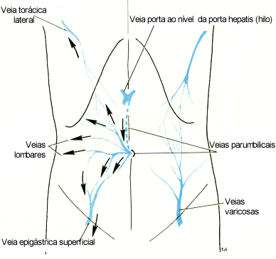fig04-06.gif