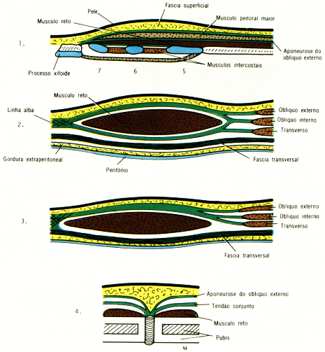 fig04-13.gif