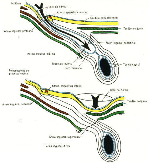 fig04-32.gif