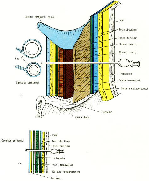 fig04-36.gif