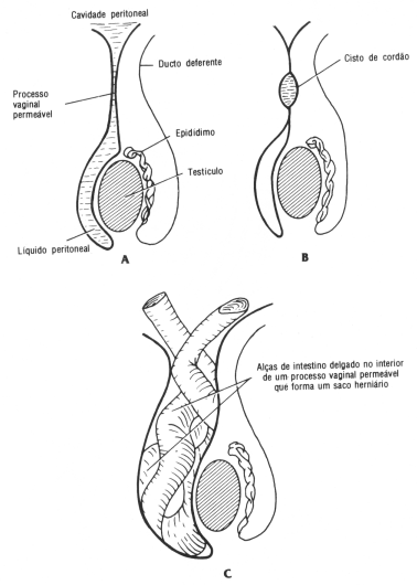 fig04-39.gif