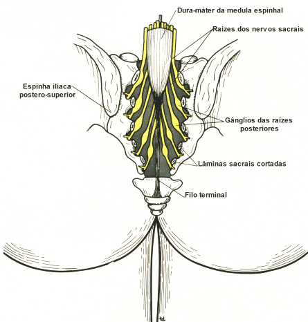 fig06-10.gif