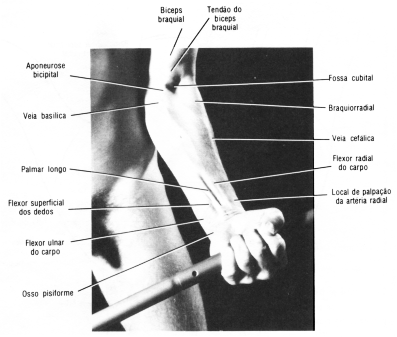 fig09-06.gif