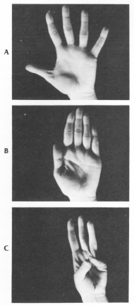 fig09-65.gif
