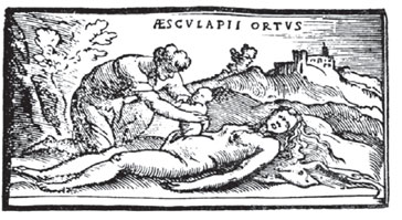 O nascimento de Esculápio: cesárea post-mortem.
