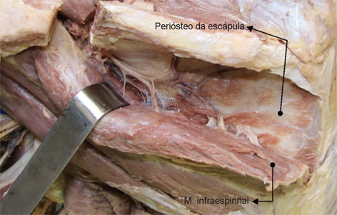 Os tendões, músculos e ligamentos fixam-se no periósteo