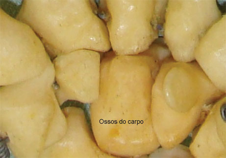 Ossos curtos: têm a forma de cubos