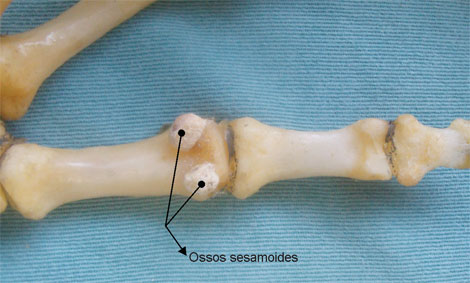 Ossos sesamoides: