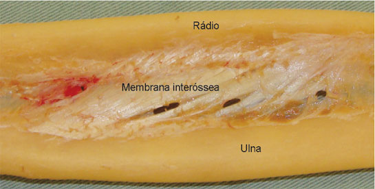 A membrana interóssea