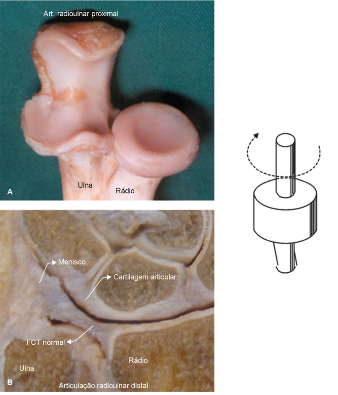 Articulação sinovial tipo trocoide
