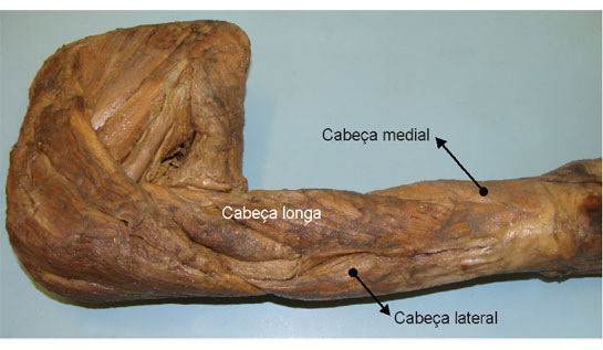 M. tríceps braquial