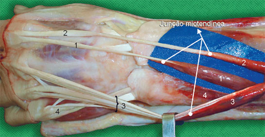 A vascularização do tendão é mais densa nos segmentos próximos ao corpo muscular