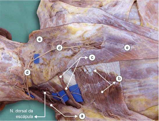 Nesta peça anatômica, o n. dorsal da escápula inerva o m. levantador da escápula
