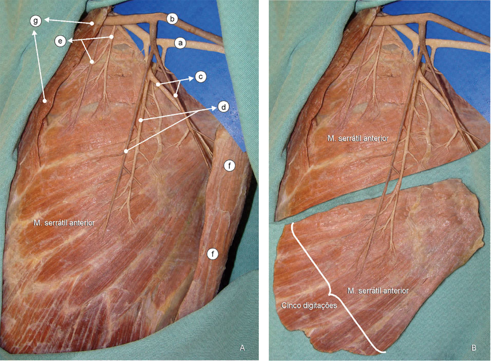 A dissecção anatômica mostra que o serrátil anterior é constituído por dez digitações