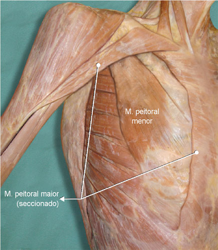 O m. peitoral menor tem formato triangular e está coberto completamente pelo peitoral maior