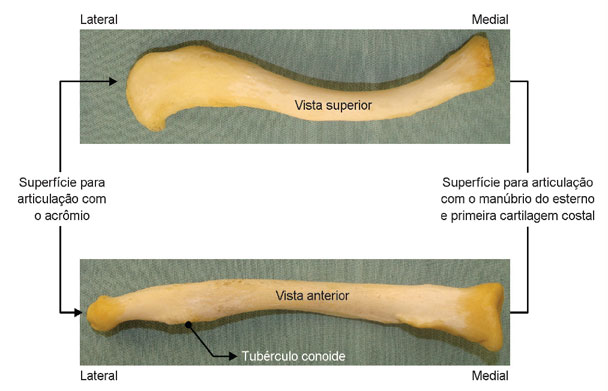 Clavícula direita. 