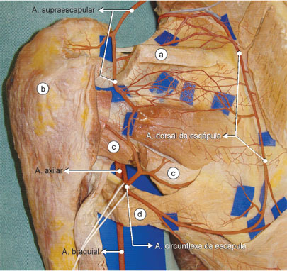 Esta dissecção anatômica mostra a circulação colateral ao redor da escápula formada pelas aa. supraescapular