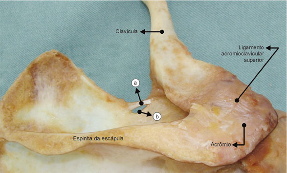 Vista superior da articulação acromioclavicular