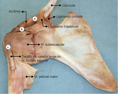 Vista anterior da articulação acromioclavicular