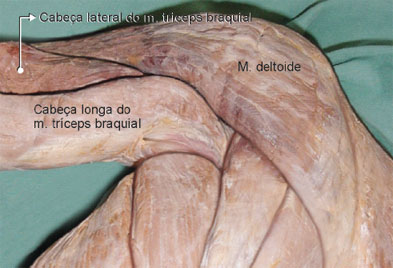 A peça anatômica mostra a origem das cabeças longa e lateral do m. tríceps braquial