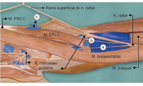 O n. radial emerge entre os mm. braquial e braquiorradial