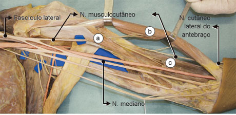 O n. musculocutâneo