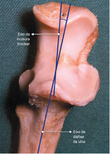 O eixo da diáfise da ulna