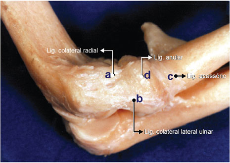 Foto da peça anatômica do compartimento lateral: ligamento colateral radial