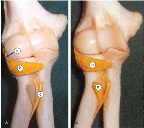 Ligamento lateral