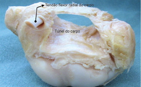 O tendão do m. flexor radial 