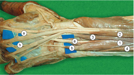 M. extensor próprio do indicador