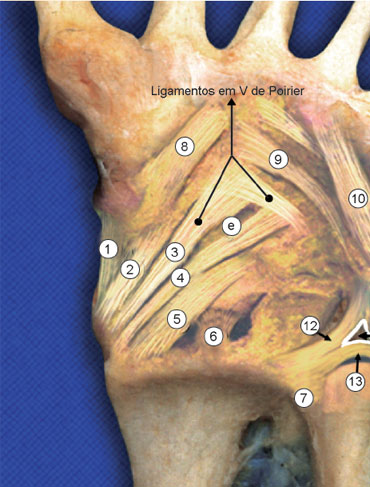 Ligamentos radiocárpicos ventrais