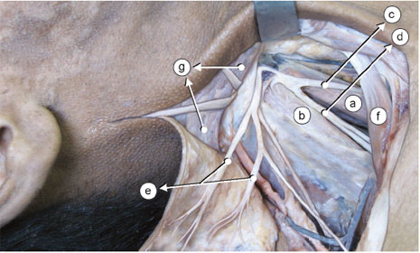 M. escaleno anterior 
