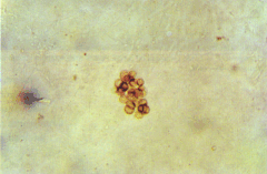 fig64-1.gif (61439 bytes)