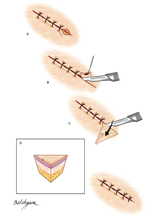fig07-03