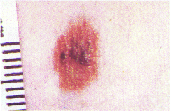 pr19.gif