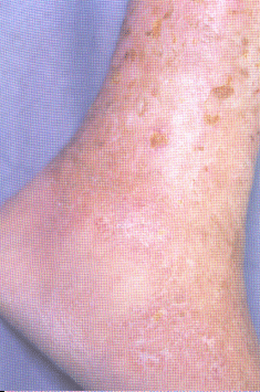 fig01-19a.gif