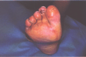 fig02-17.gif